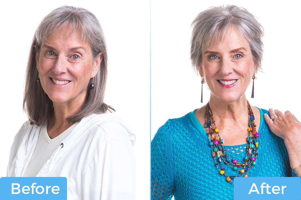 Susan's before and after short pixie hairstyle